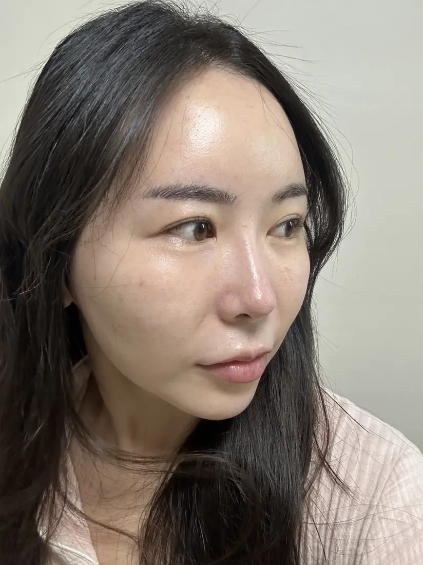 AFTER