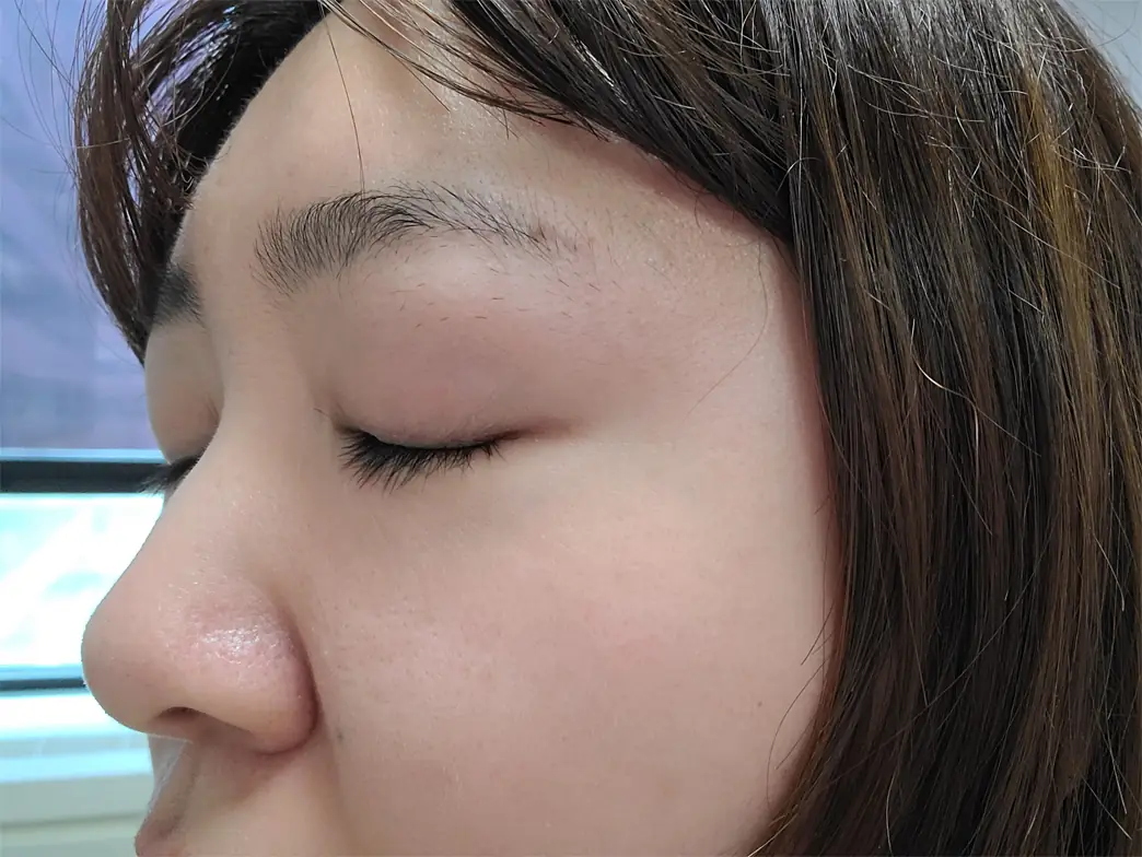 AFTER