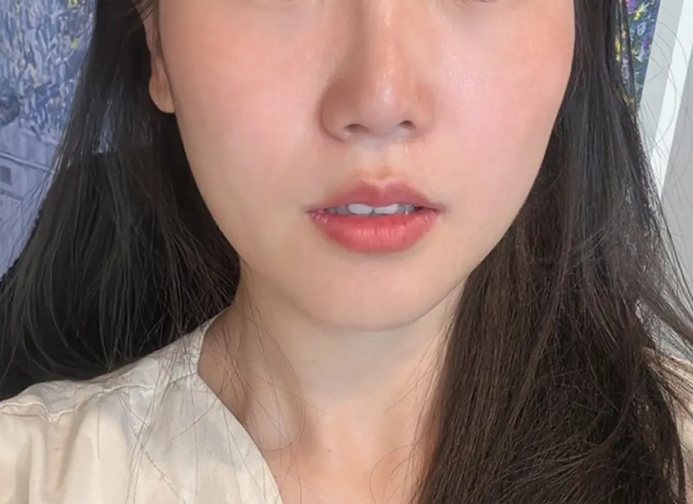 AFTER