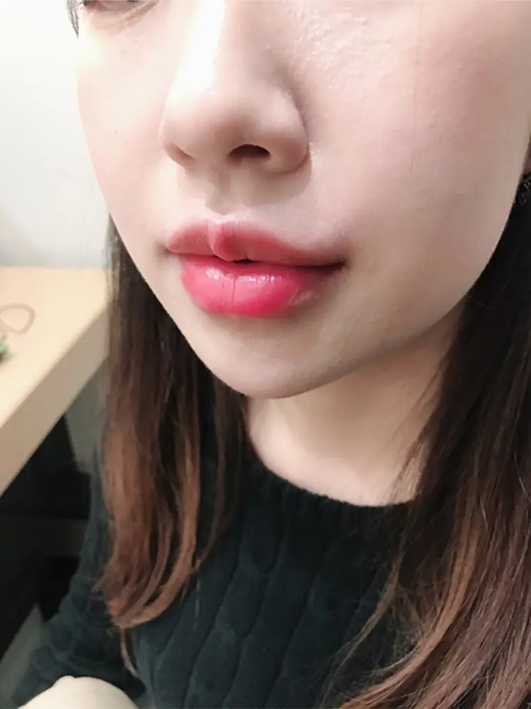 AFTER
