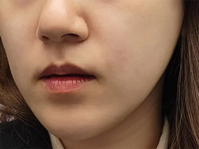 After