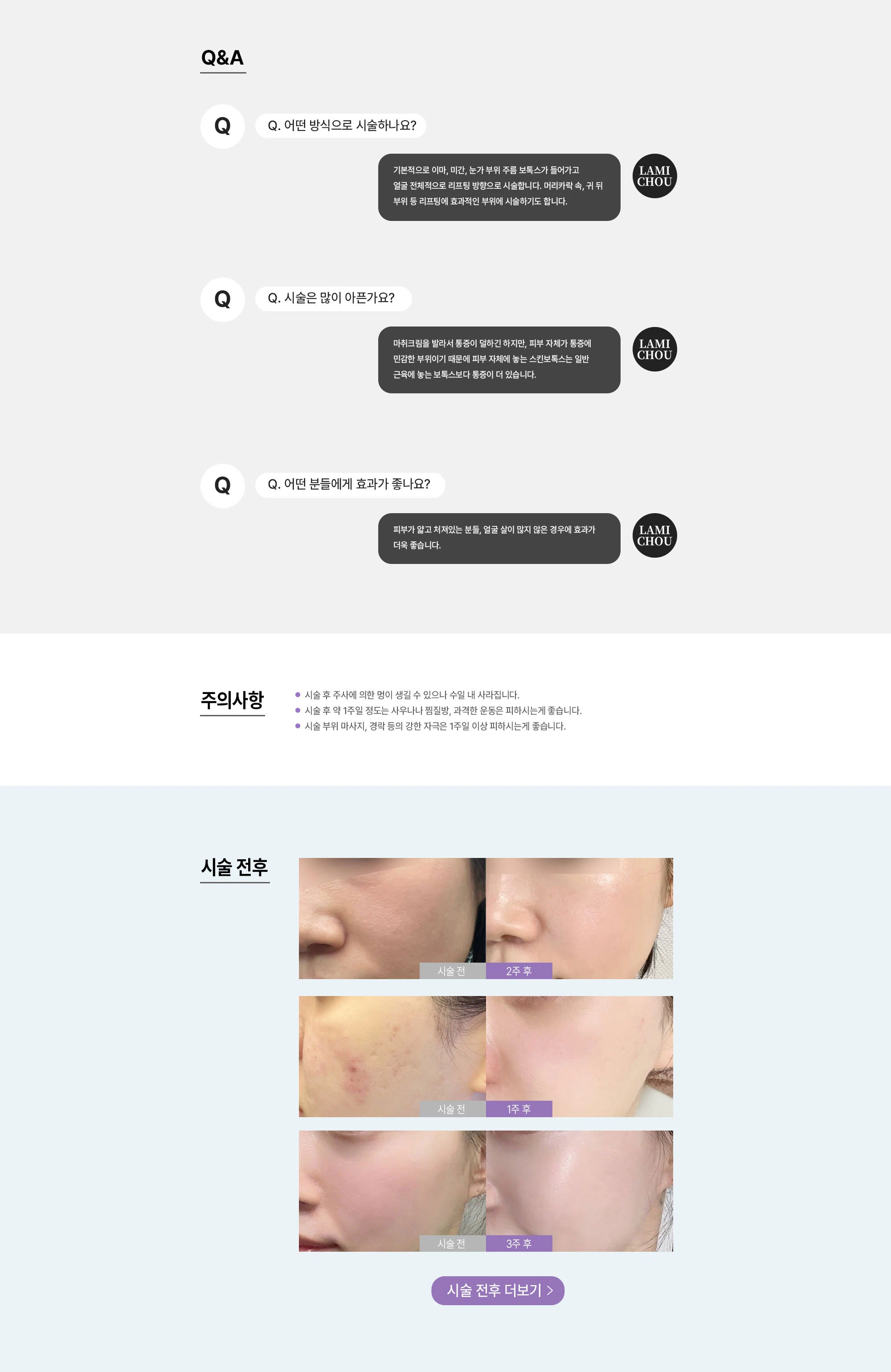 스킨보톡스