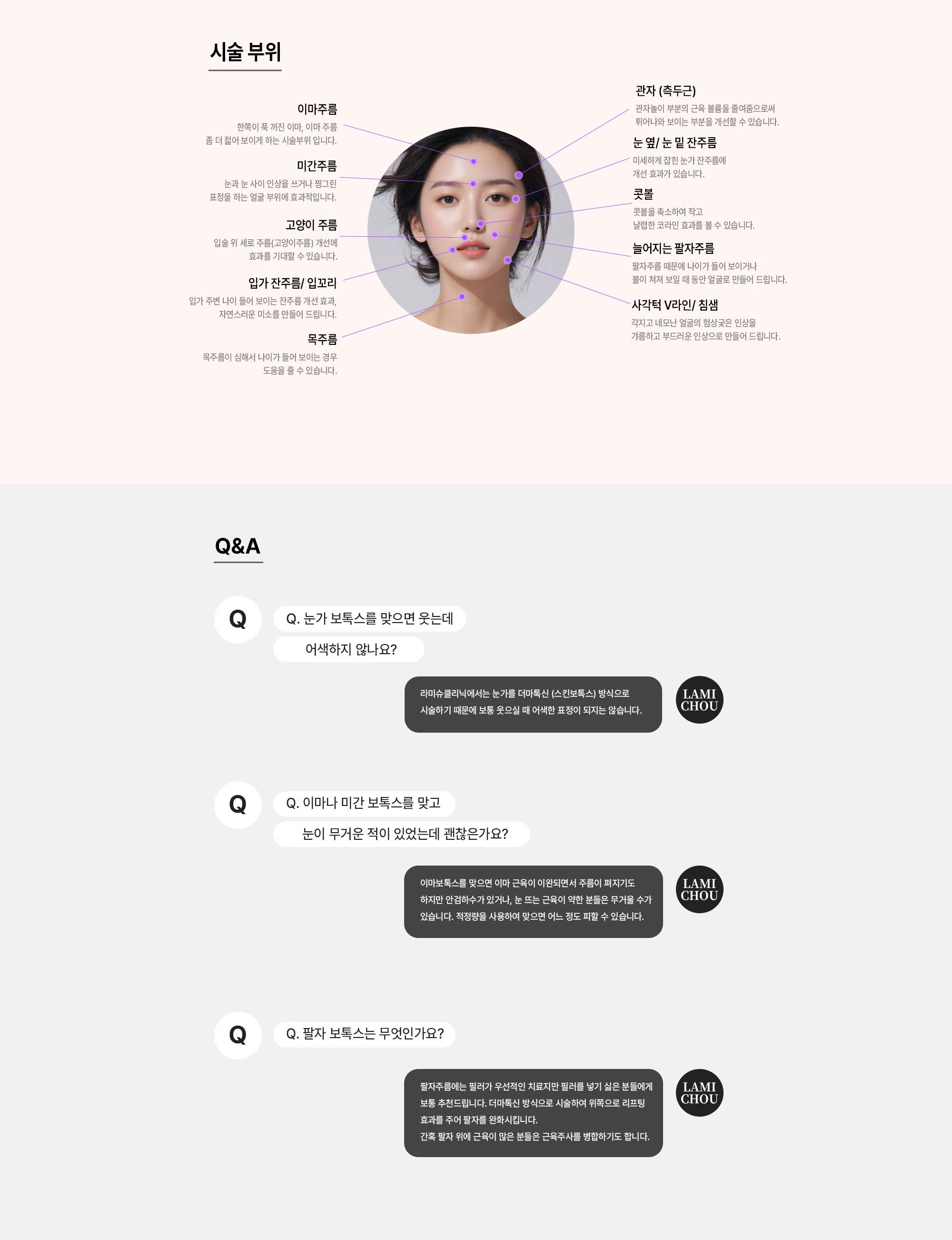 주름 보톡스