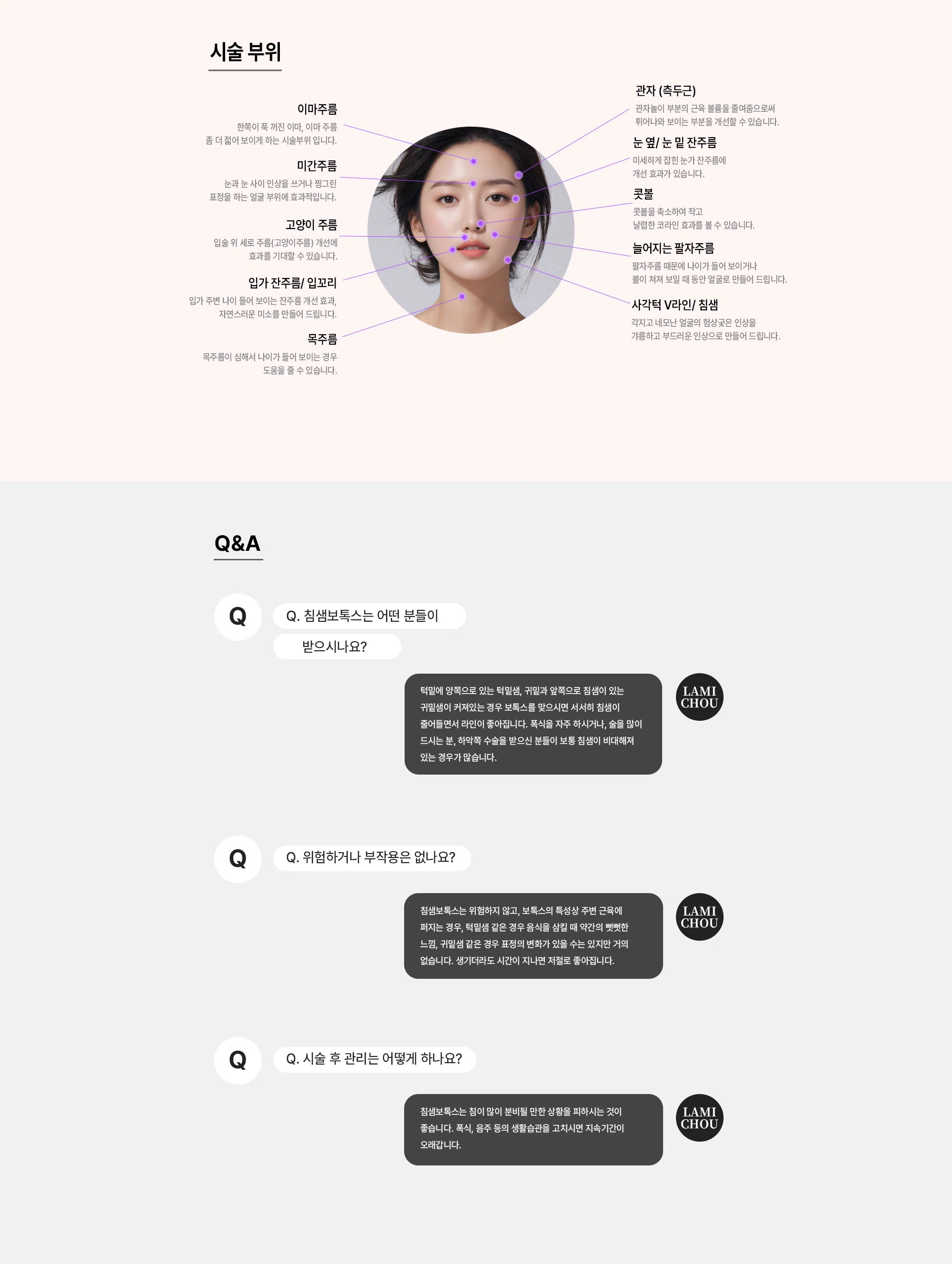 침샘보톡스