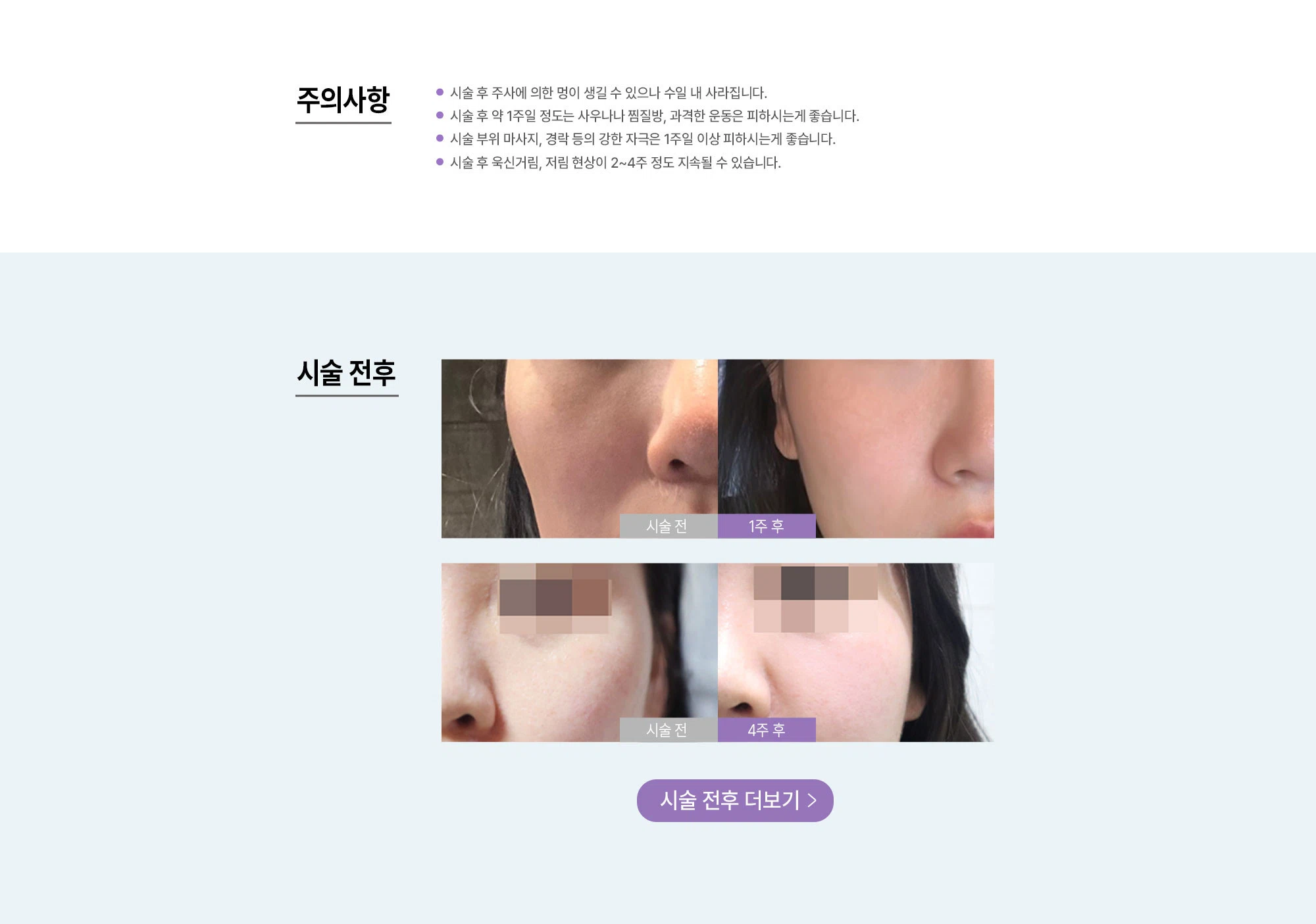 듀얼광대씬주사