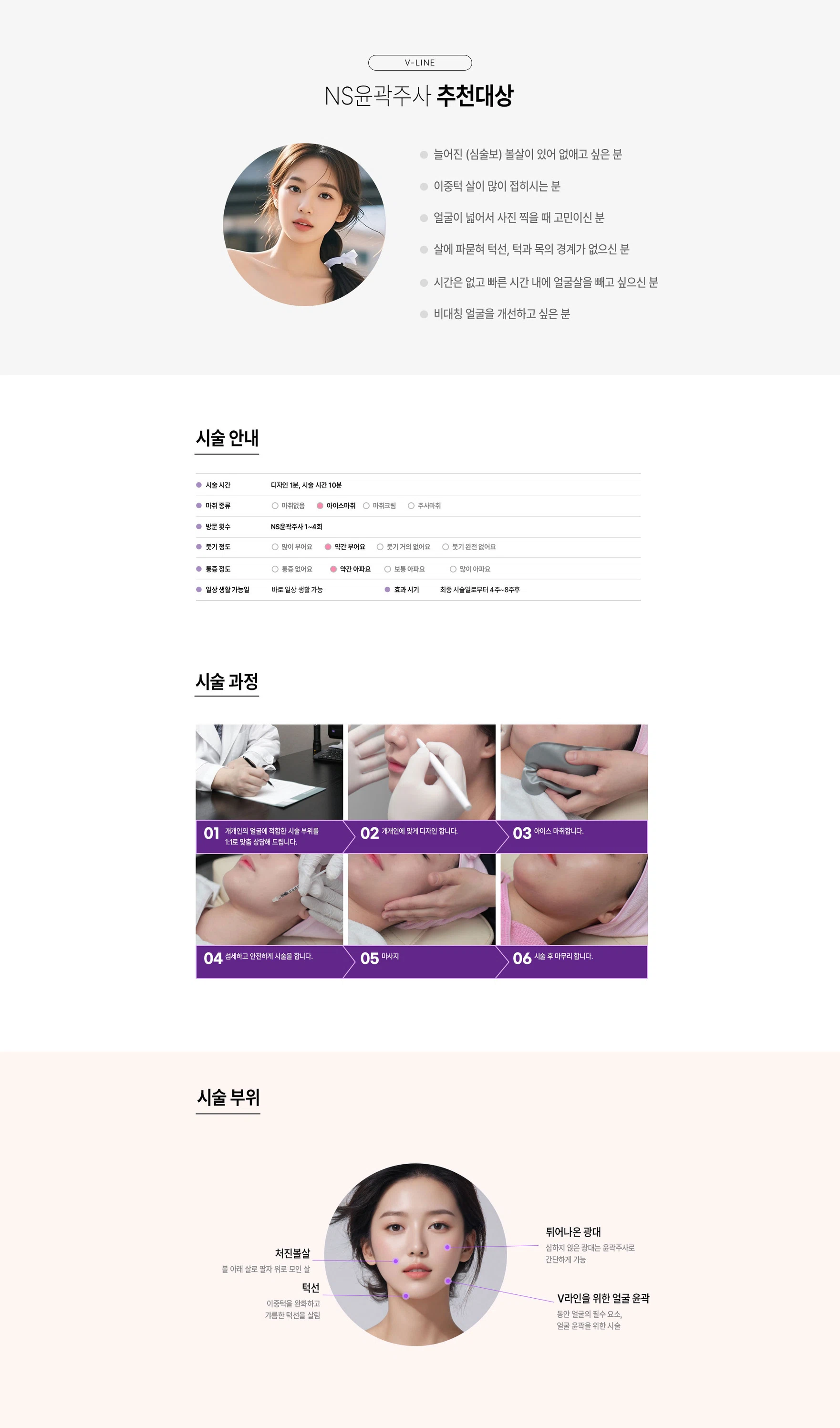 NS윤곽주사