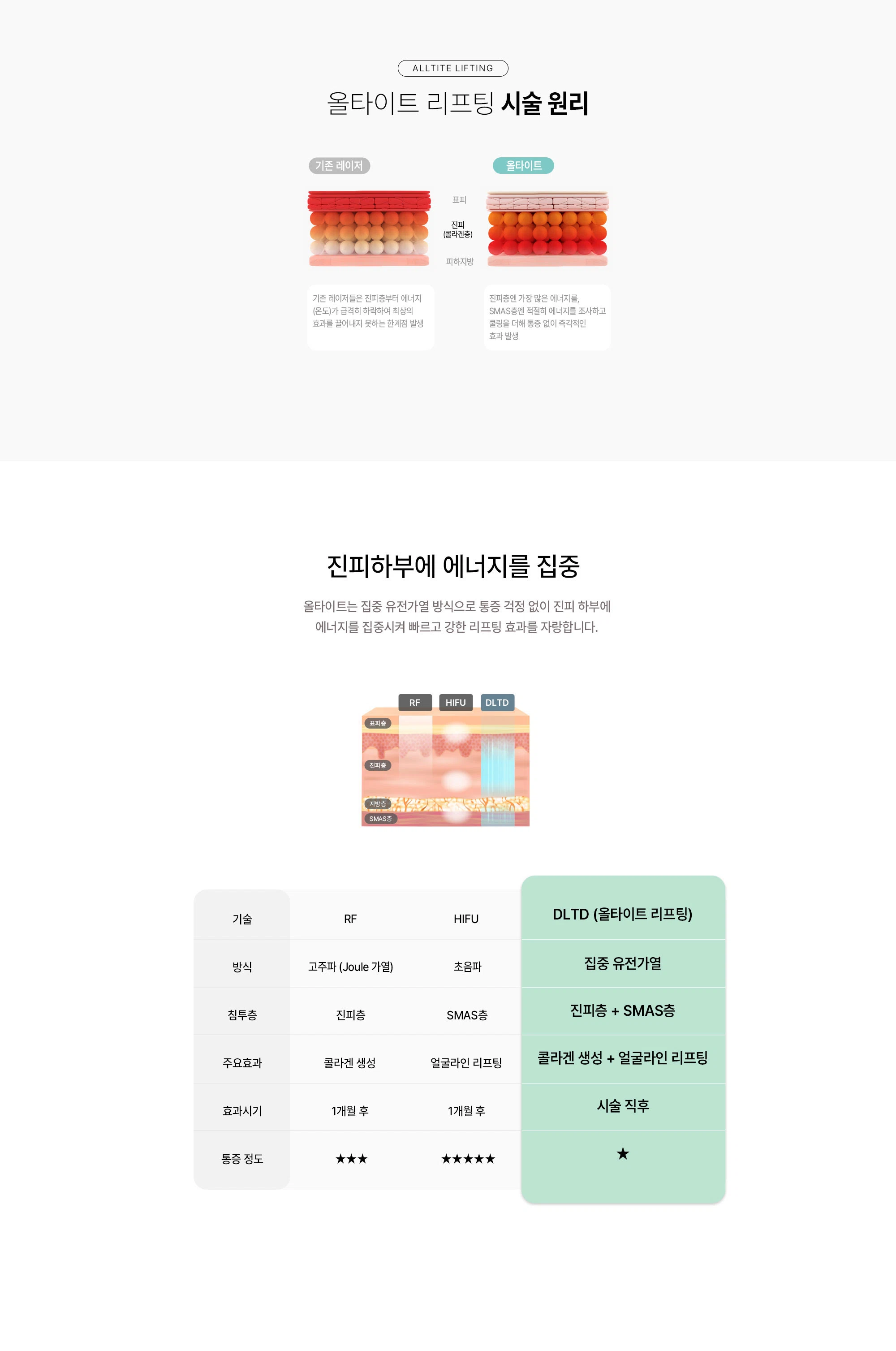 울타이트 리프팅