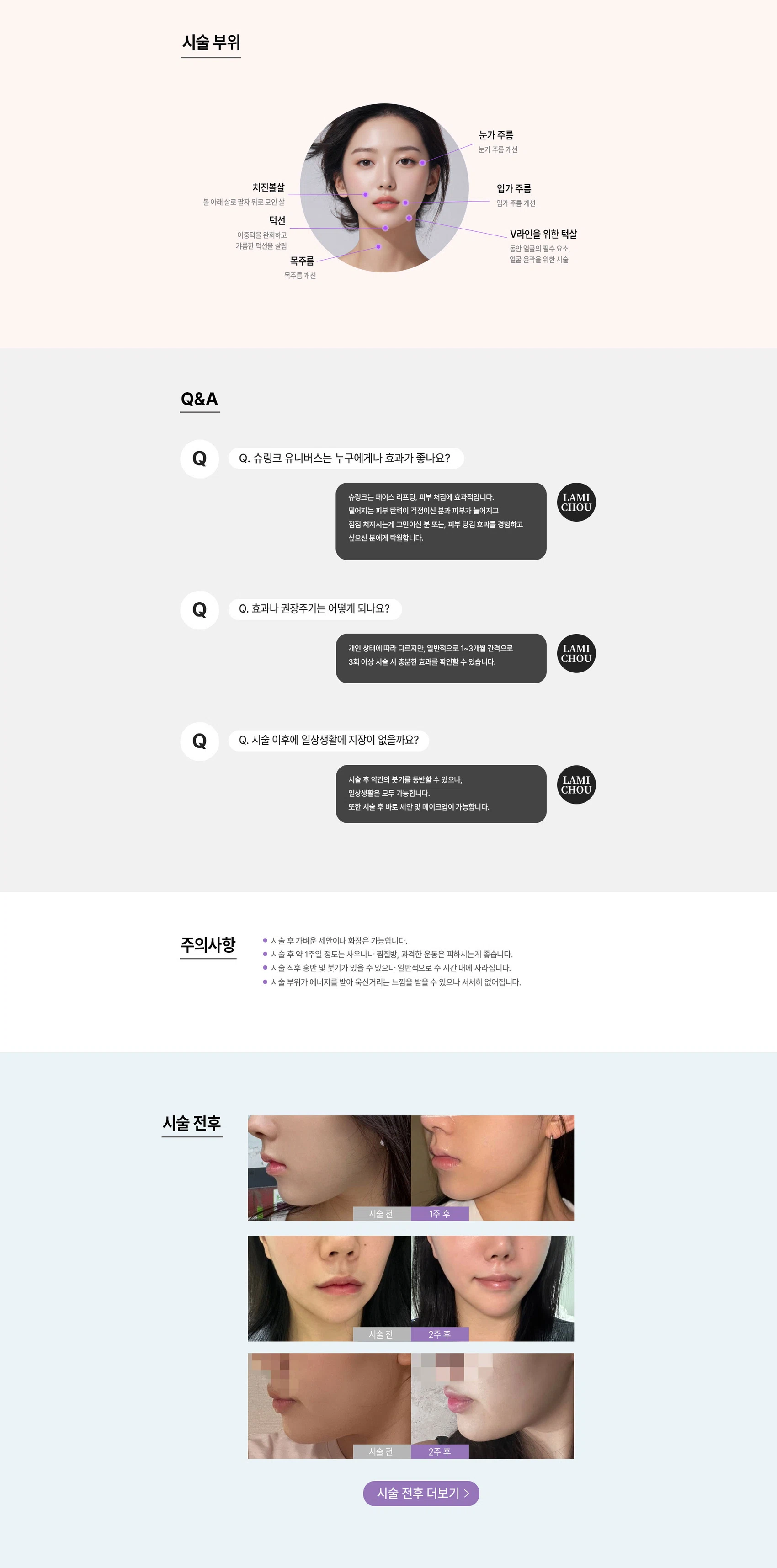 슈링크 유니버스