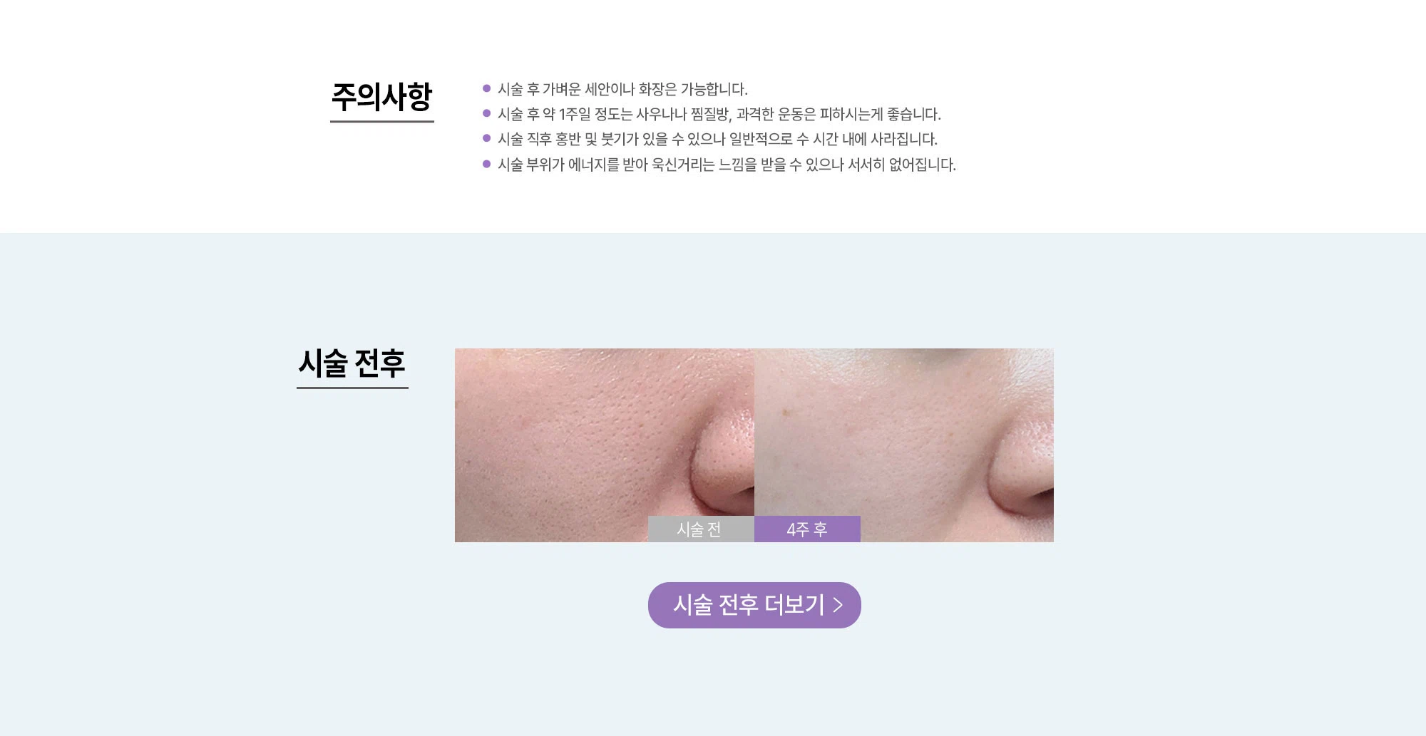 모공