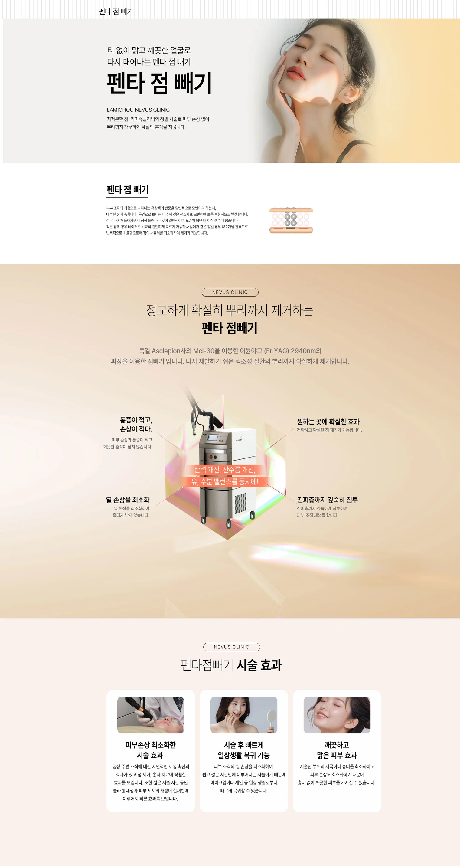 펜타점 빼기