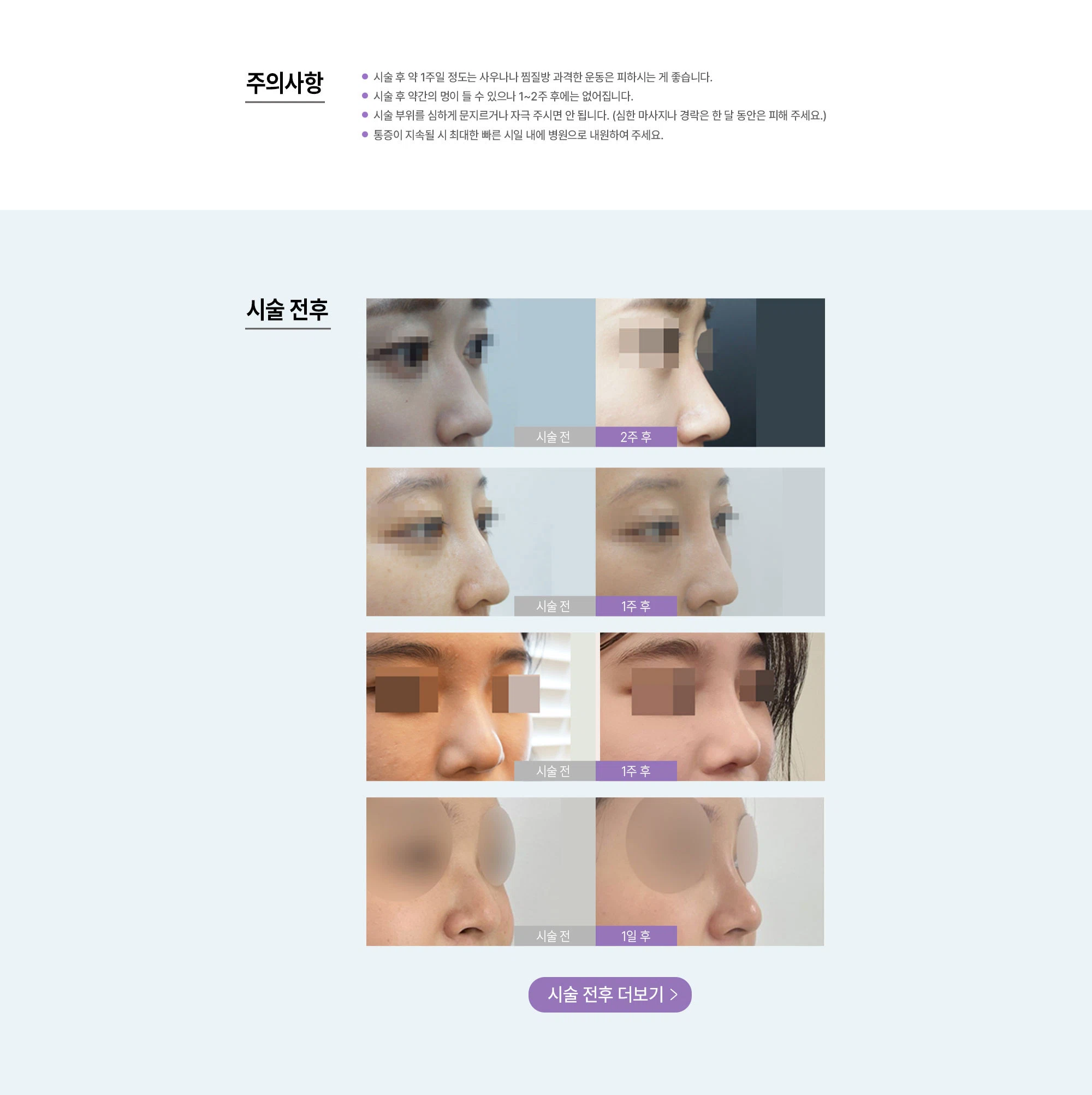 명품 코필러